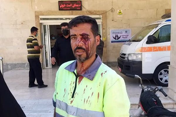 ایاد کیانی، کارگر معترضی که در روز سه‌شنبه ۴ آبان با حمله یکی از اعضای شورای شهر خرمشهر زخمی شد