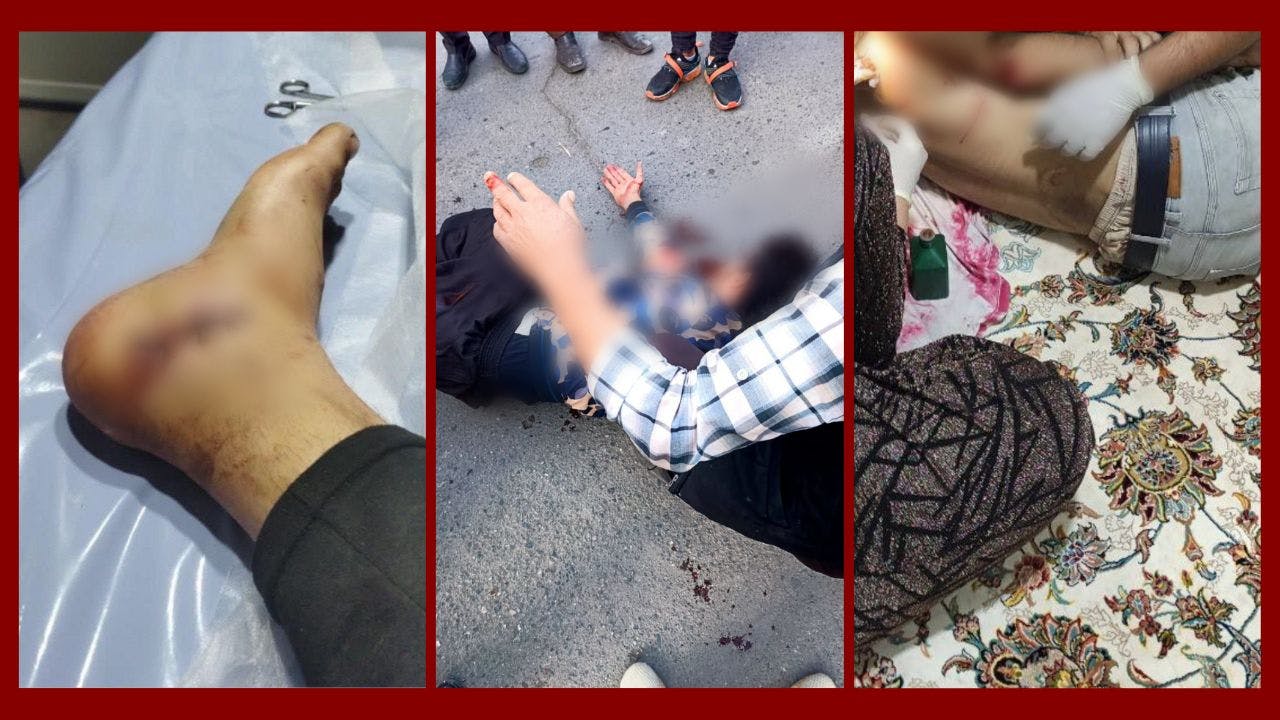 سه تصویر از زخمی‌شدگان در اعتراضات اشنویه