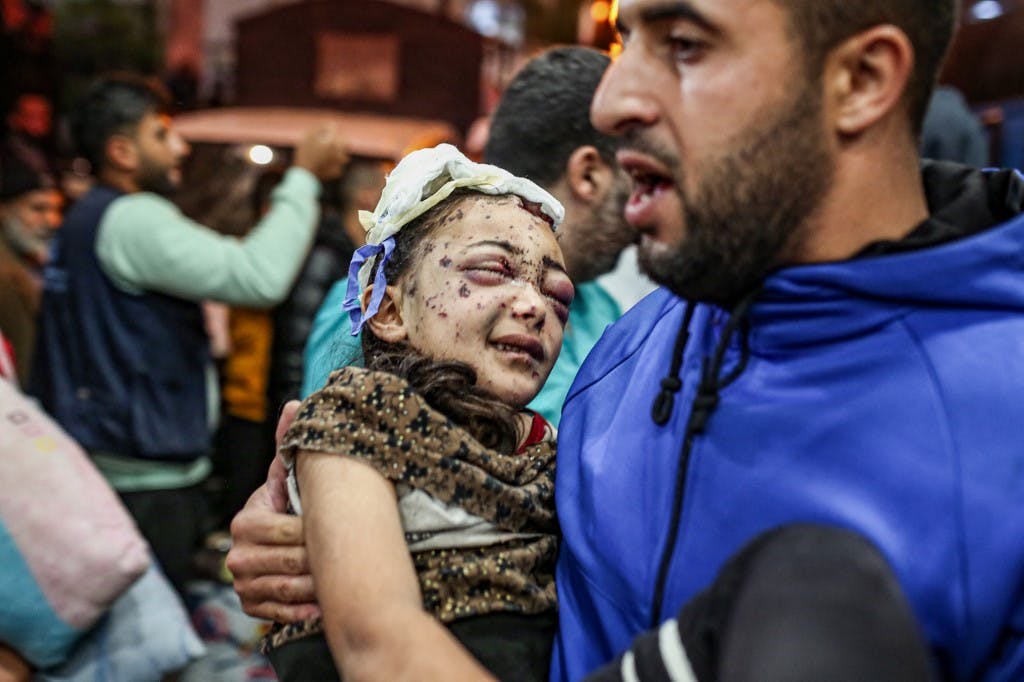 ۲۰ نوامبر ۲۰۲۳، یک کودک مجروح فلسطینی را از بیمارستان اندونزیایی غزه خارج می‌کنند.